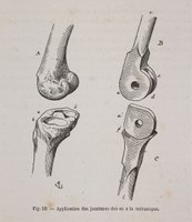 Mechanical Application of Bone Joints, in Eugène- Emmanuel Viollet- le- Duc, [em]Histoire d’un dessinateur: Comment on apprend à dessiner[/em] (1879).