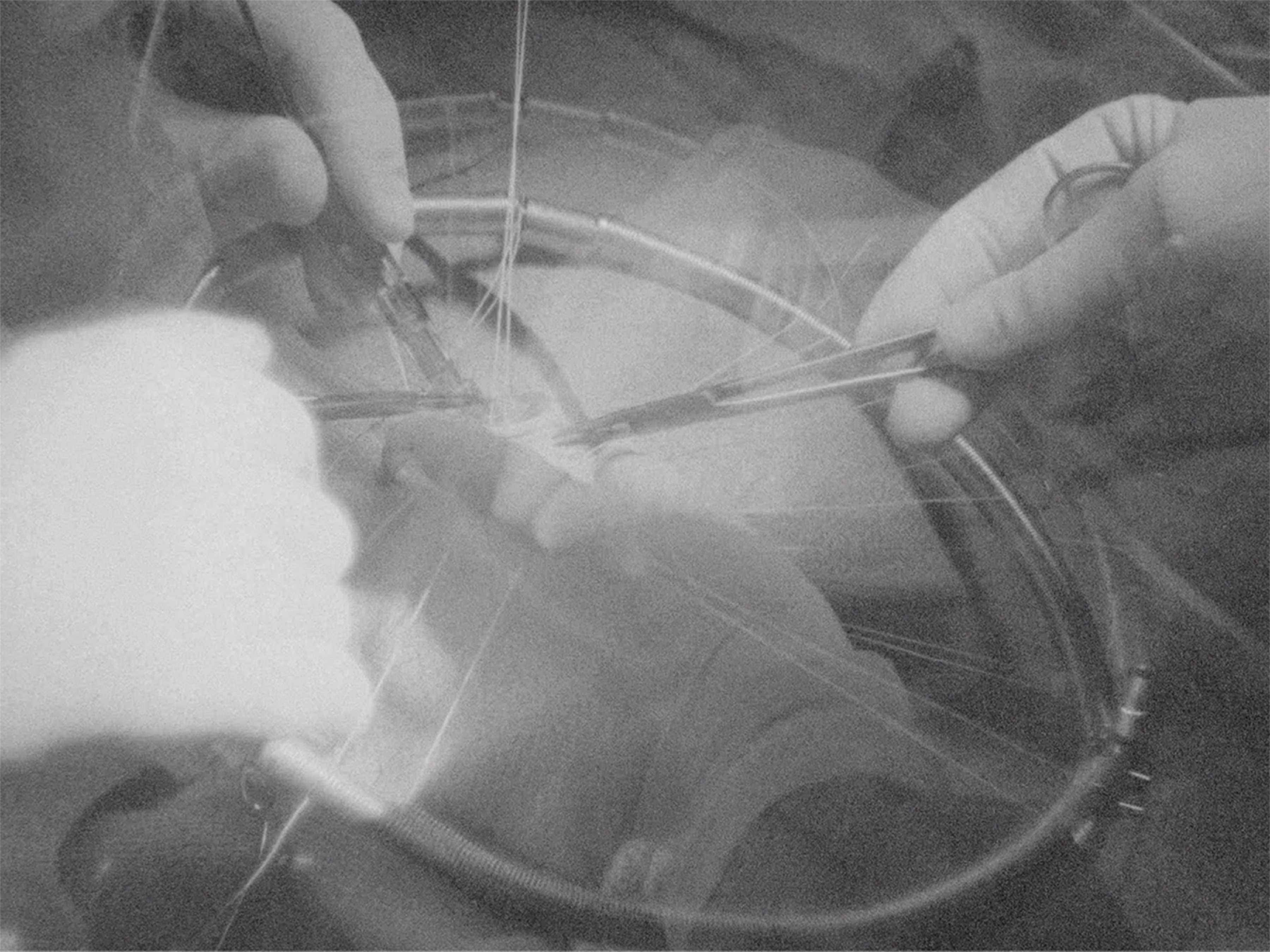 Christina Lammer, [em] Stitches in the Heart [/em], still image of the 16 mm short film of the same name, 2019 © Christina Lammer